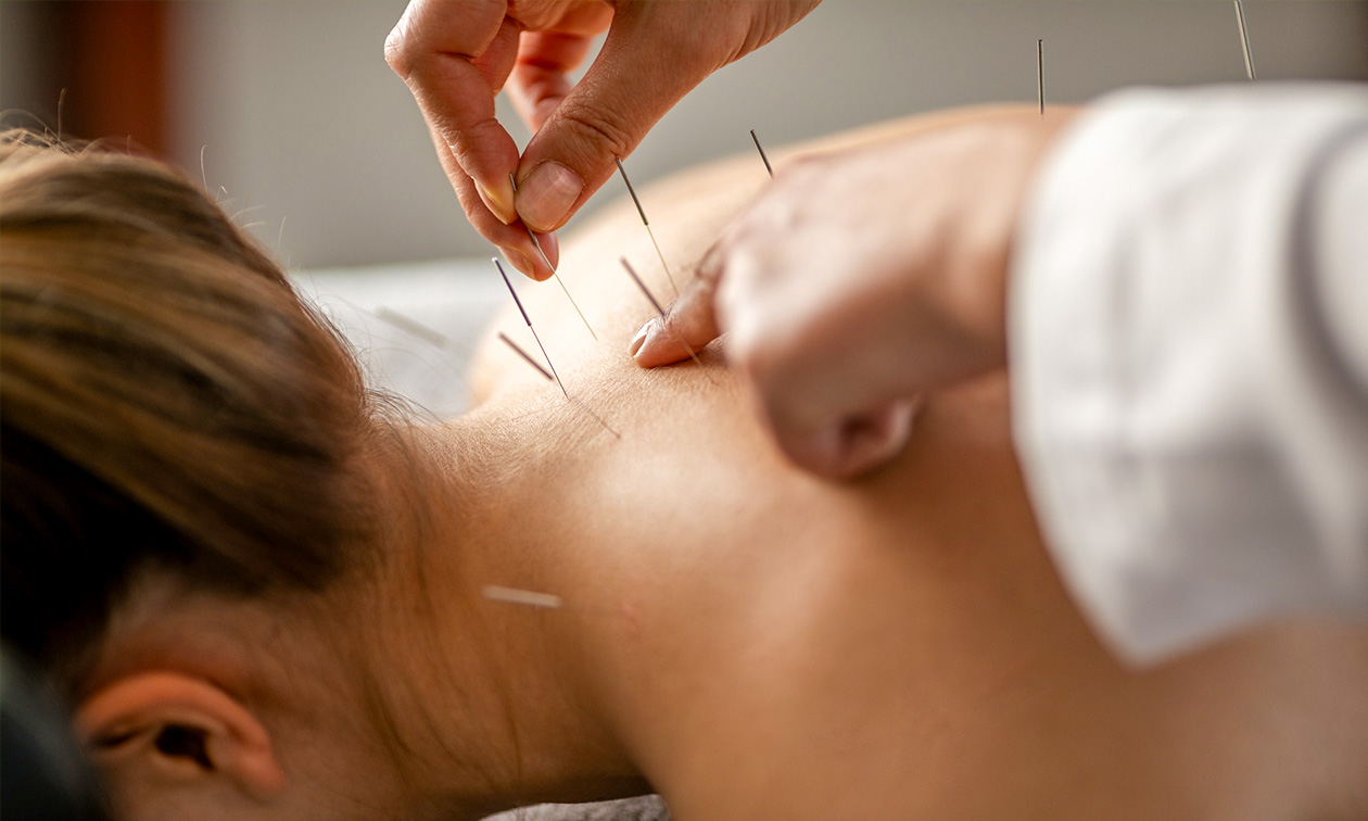 Rhea Praktijk voor Acupunctuur